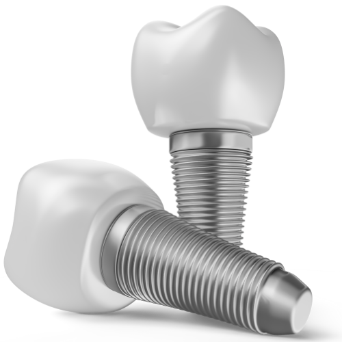 Dental Implants